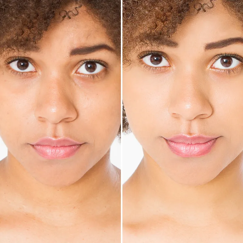 Before and after split image showing facial skin brightening and improved complexion from daily beauty cream application.