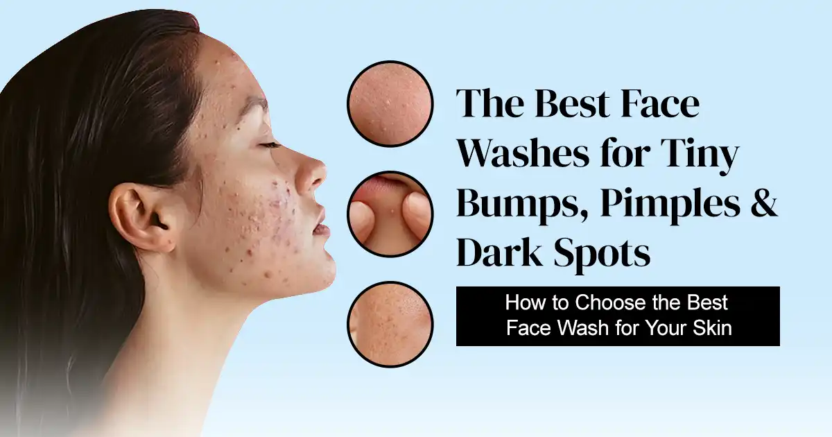 best face wash to remove pimples and dark spots